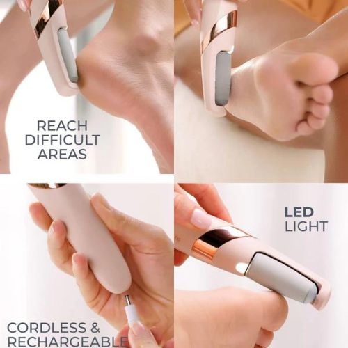 Electric Foot File | Remove Dead Skin & Calluses with Ease