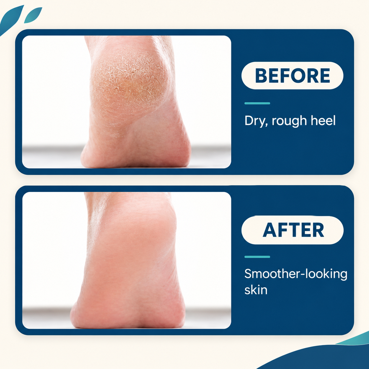 ZuvaHome™ Electric Foot File