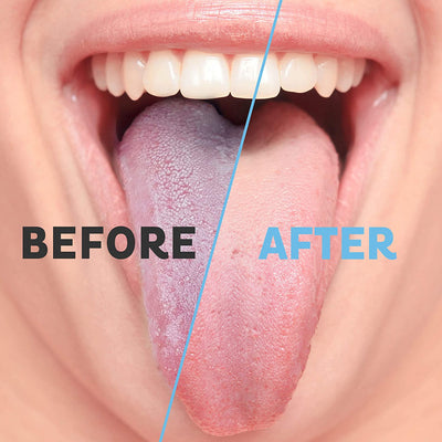 Tongue Scraper (2 Pack) - (Reduce Bad Breath)